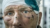 Volunteer doctors help the homeless on the streets of St. Petersburg. 
