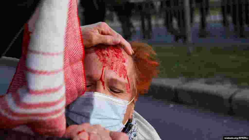 Пострадавшая во время разгона демонстрации 23 сентября в Минске. Тогда в столице Беларуси и других городах прошли массовые акции протеста, вызванные инаугурацией Лукашенко. Силовики жестко действовали в отношении протестующих, в Минске применили водометы и перцовый газ. МВД сообщило о 364 задержанных, из них 252 – в Минске.