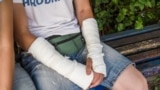 Belarus - Hrodna.Life journalist Ruslan Kulevich that was detainted during the protests. Riot police brohe his arm. Hrodna, 2Sep2020